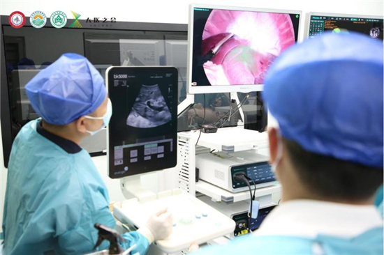 更稳定、更智能、更清晰精准!海信医疗携4K荧光高端医用内窥镜首次亮相(图3)